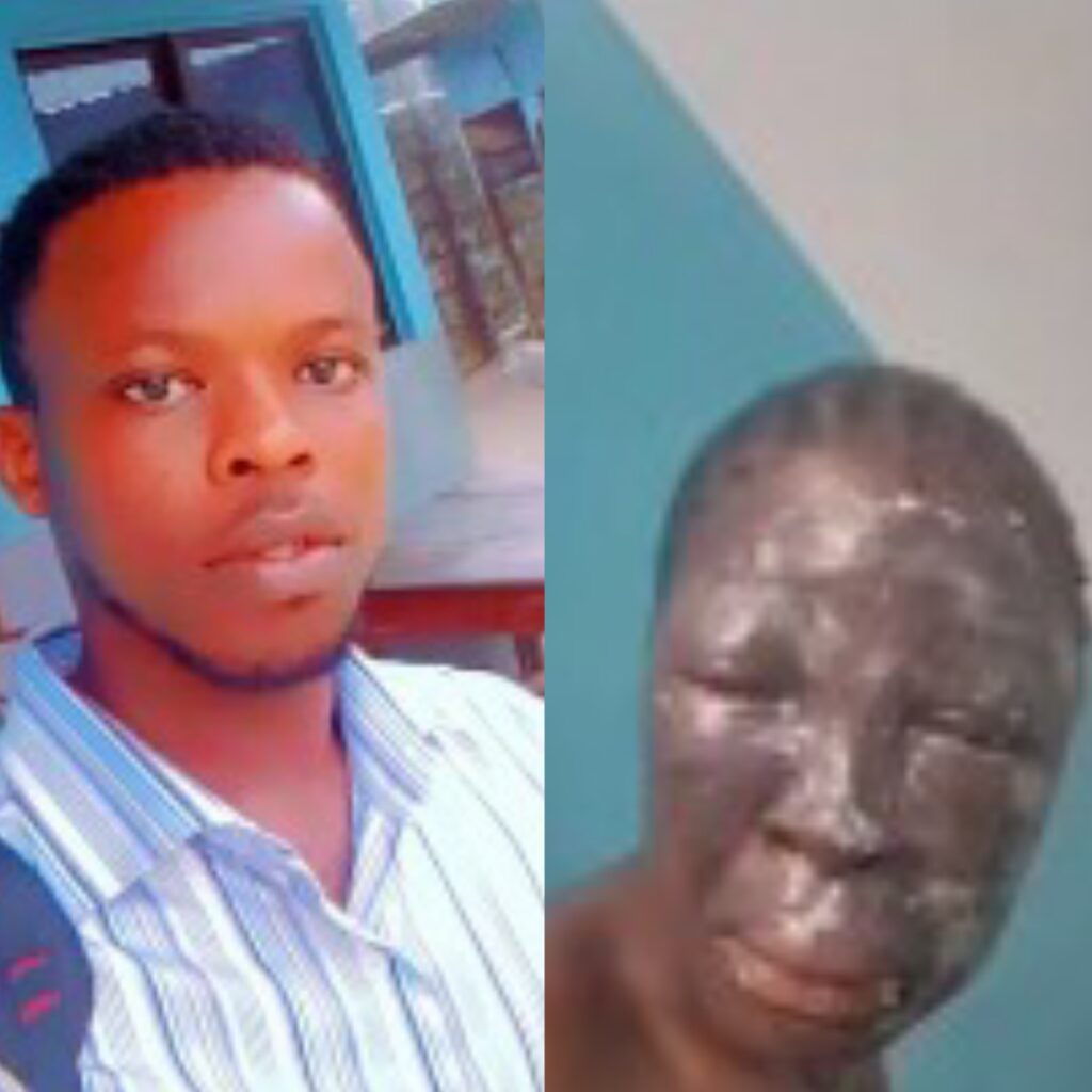 Godstime Didimako alongside Blessing, the victim of his brutal acid attack.