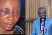 Photo collage of screenshot from viral video of Glory Agbor with a swollen face and Hon. Ovat Dickson Agbor. 