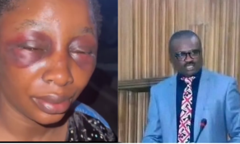 Photo collage of screenshot from viral video of Glory Agbor with a swollen face and Hon. Ovat Dickson Agbor. 