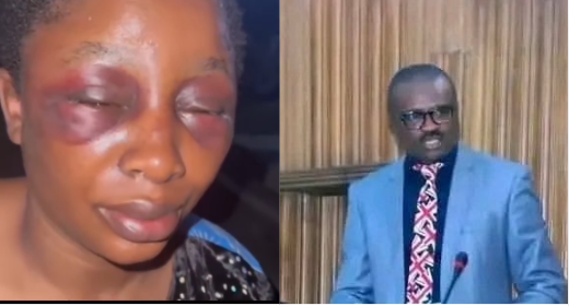Photo collage of screenshot from viral video of Glory Agbor with a swollen face and Hon. Ovat Dickson Agbor. 