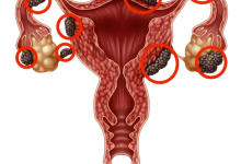 Photo Source: One HealthCare