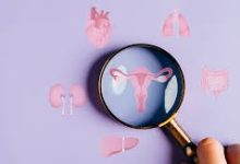 PCOS Officially Renamed PMOS in Global Health Move 3 Photo source: Diabetesontheinternet
