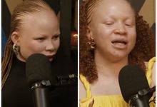 “I was Denied Job because I’m Woman with Albinism,” Lady Recounts 3 “I was Denied Job because I’m Woman with Albinism,” Lady Recounts