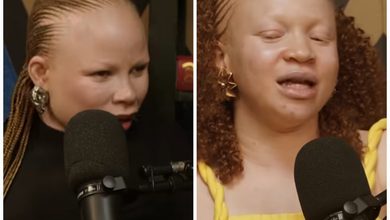 “I was Denied Job because I’m Woman with Albinism,” Lady Recounts