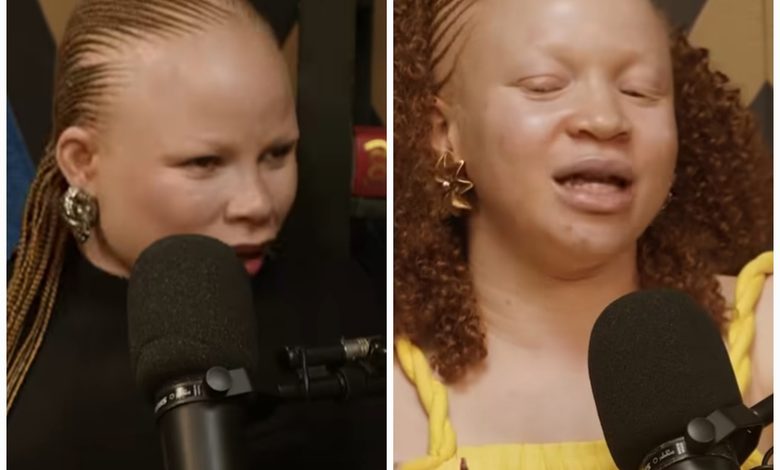 “I was Denied Job because I’m Woman with Albinism,” Lady Recounts
