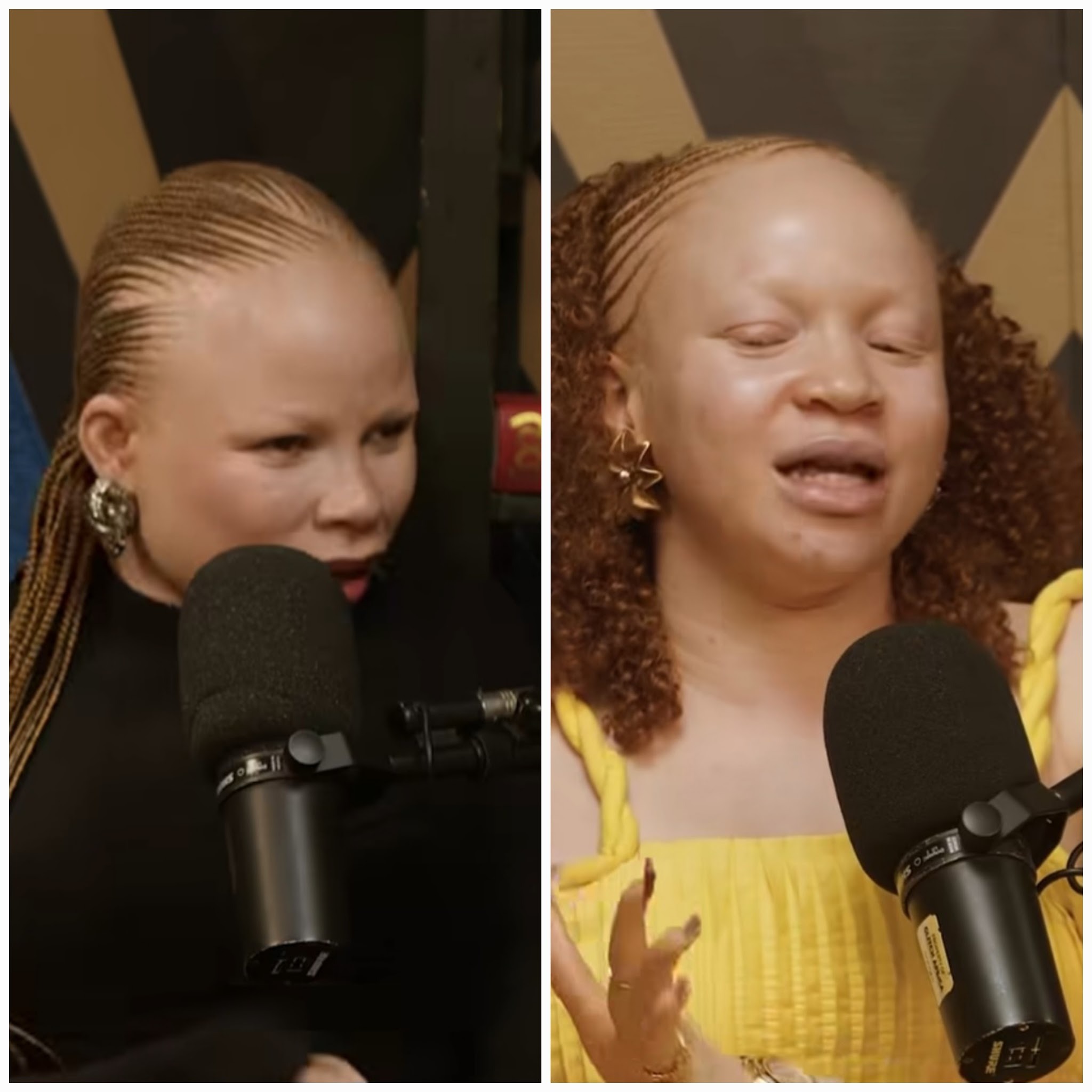 “I was Denied Job because I’m Woman with Albinism,” Lady Recounts